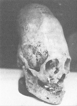 Museo de Ica, cr�neo largo
                                  deformado 02