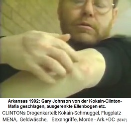 Arkansas 1992: Gary Johnson von der Kokain-Clinton-Mafia geschlagen, ausgerenkte Ellenbogen