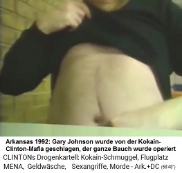 Arkansas 1992: Gary Johnson von der Kokain-Clinton-Mafia geschlagen, der ganze Bauch wurde operiert