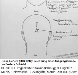Fiske-Bericht vom 30. Juni 1994 �ber Fosters Tod: Da soll am Sch�del eine Ausgangswunde gewesen sein