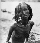 Drought and famine in Eritrea:
                            Emaciated woman