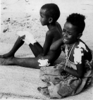 Eritrea: Hurt children without clothes