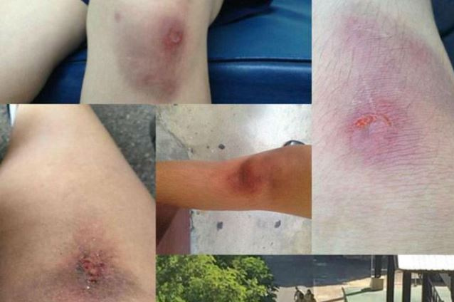 Thailands Terror: Die kaputten Knie der
                      M�dchen vom M�dchengymnasium im Distrikt Khlong
                      Toei - Meldung vom 13.12.2014