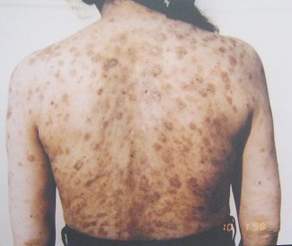 Agent-Orange-Opfer Hoang Thi Ngoc Van: Hoang Thi Ngoc Van, geboren 1945 aus der Provinz Quang Binh. Agent-Orange-Opfer Hoang Thi Ngoc Van: Hoang Thi Ngoc Van, geboren 1945 aus der Provinz Quang Binh.