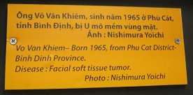 Agent-Orange-Opfer Vo Van Khiem, Text: Vo Van Khiem - geboren 1965, aus dem Distrikt Phu Cat, Provinz Binh Dinh. Seine Krankheit war ein Weichgewebe-Tumor im Gesicht. Foto: Nishimura Yaichi Agent-Orange-Opfer Vo Van Khiem, Text: Vo Van Khiem - geboren 1965, aus dem Distrikt Phu Cat, Provinz Binh Dinh. Seine Krankheit war ein Weichgewebe-Tumor im Gesicht. Foto: Nishimura Yaichi