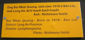 Agent-Orange-Opfer Agent-Orange-Opfer