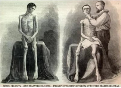Ausgehungerte H�ftlinge in den
                        "USA" nach dem B�rgerkrieg von 1865