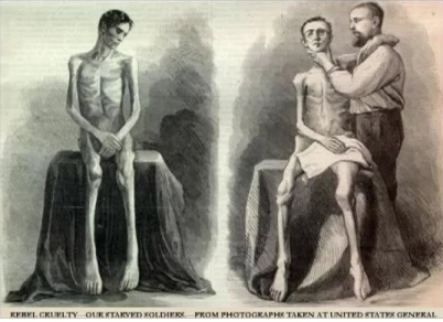 Emaciated captives in the
                        "U.S.A." in Andersnoville after civil
                        war of 1865