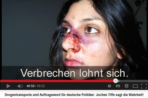 Eine Frau mit einem genhten
                            Nasenbeinbruch - die muslimischen und die
                            linken Schlger werden von der Klner Justiz
                            nie bestraft