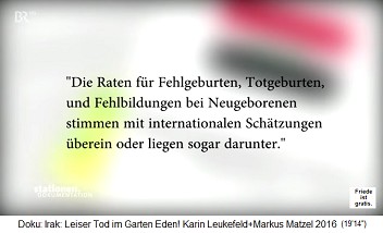 Die kriminelle IL-UNO-NWO behauptet, die Rate an Fehlbildungen bei Babys im Irak sei seit 1991 gleich geblieben oder läge sogar darunter Die kriminelle IL-UNO-NWO behauptet, die Rate an Fehlbildungen bei Babys im Irak sei seit 1991 gleich geblieben oder läge sogar darunter