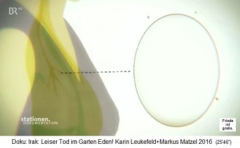 Der Trickfilm: Uranstaub gelangt in die Lunge