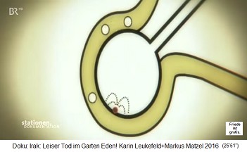 Der Trickfilm: Der nicht l�sliche Uranstaub setzt sich in der Lunge fest und strahlt ohne Ende