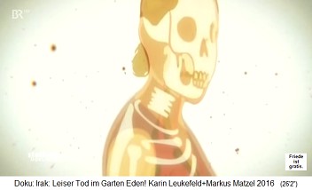 Trickfilm: Das Uran zerst�rt Knochen und Knochenmark und provoziert so Leuk�mie