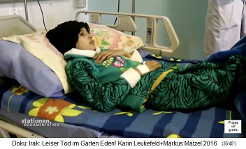 Basra (Irak): Im neuen Kinderkrankenhaus für Krebskinder schaut eine Jugendliche fern Basra (Irak): Im neuen Kinderkrankenhaus für Krebskinder schaut eine Jugendliche fern
